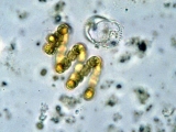 Цианобактерии или сине-зелёные во́доросли (лат. Cyanobacteria)